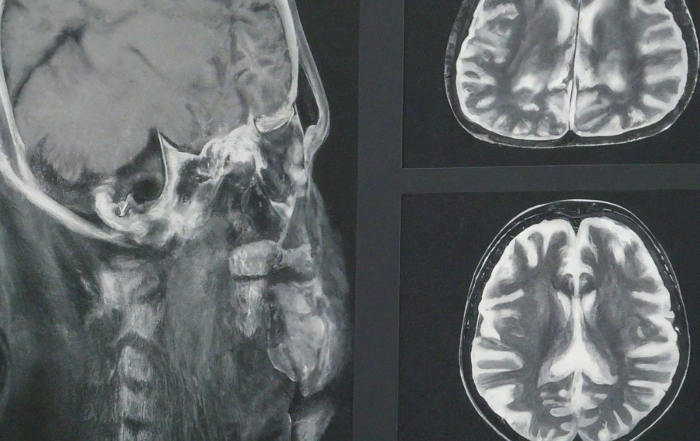 Hjerne scanning